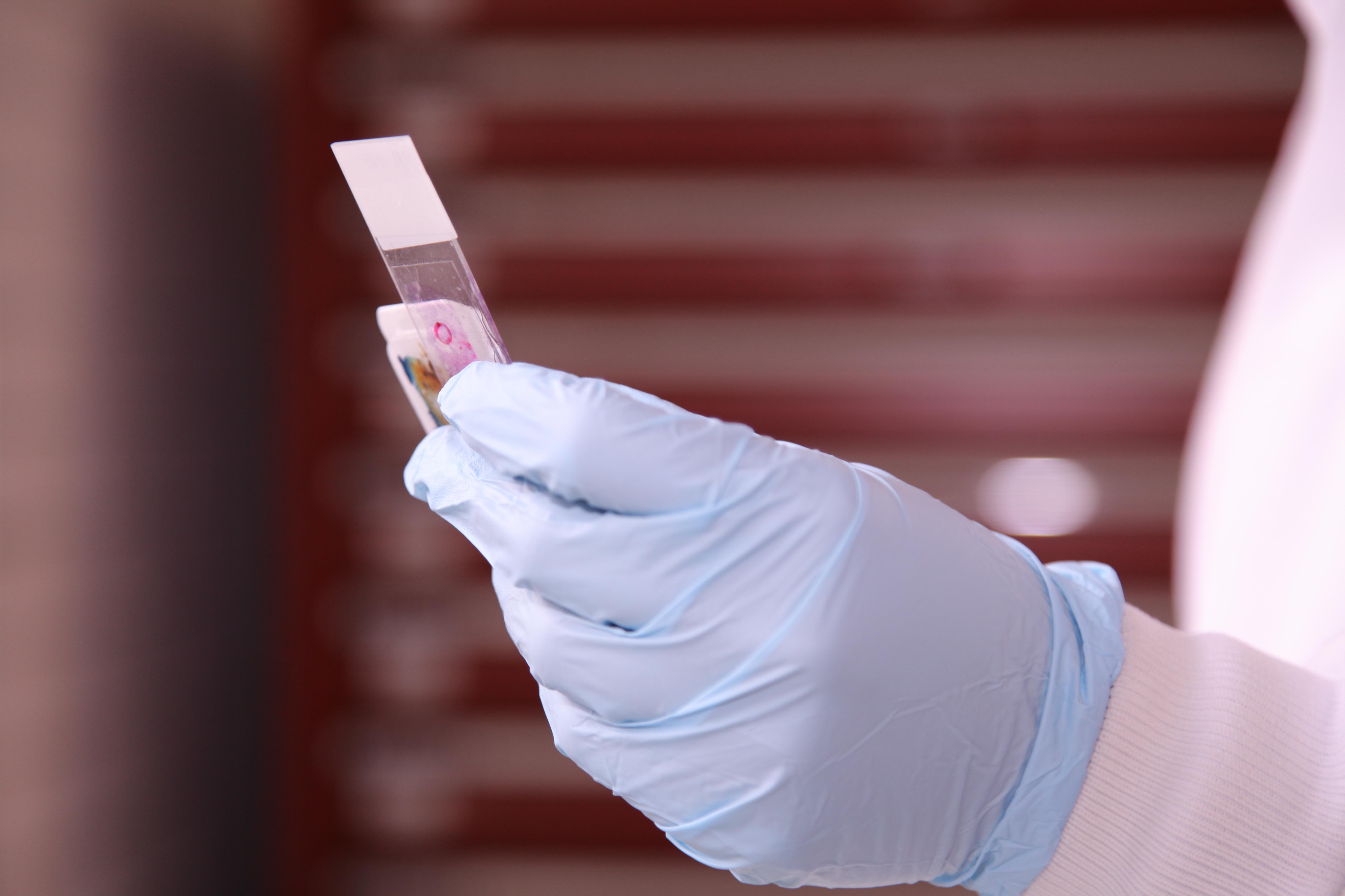 Researcher's hand, wearing a blue glove and holding a microscope slide.