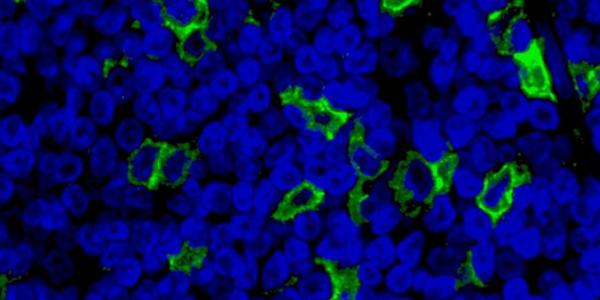 DLBCL immunofluorescence - PMCH FITC