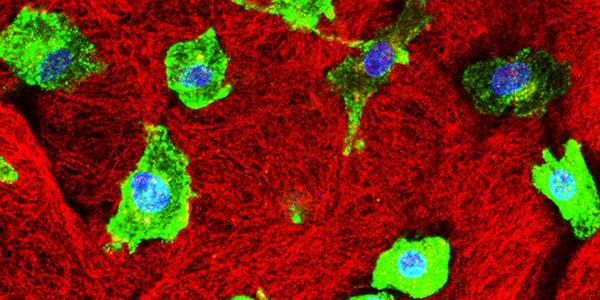 Human macrophages on human decellularised ovary extracellular matrix