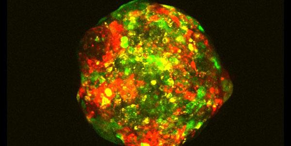 Multiclonal cancer cell line spheroid