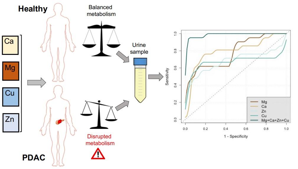 Research has revealed that the signature of metal ions present in urine samples is an accurate indicator of pancreatic ductal adenocarcinoma.