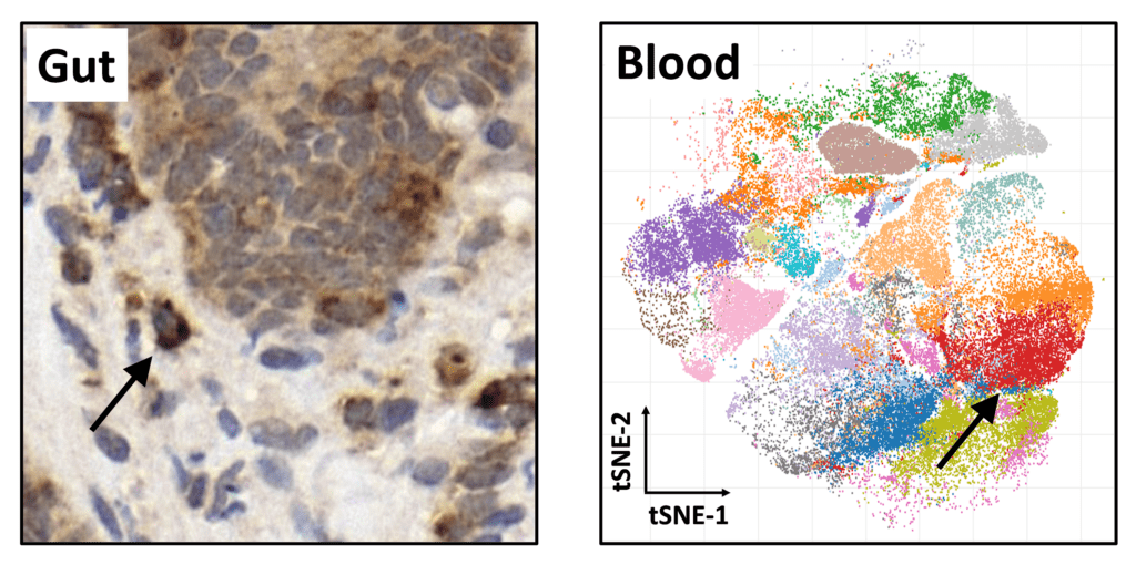 Novel insights into graft-versus-host disease.