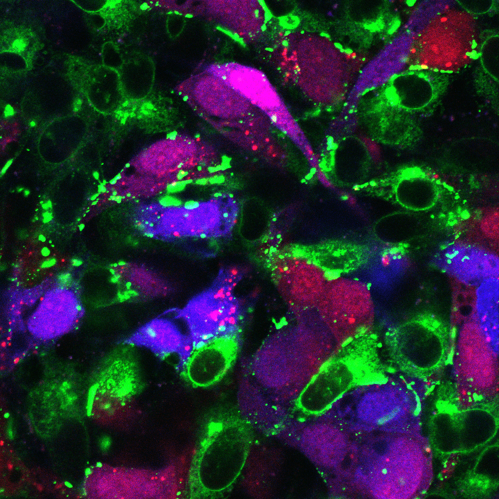 Understanding the role of the bone marrow in blood cell health and disease