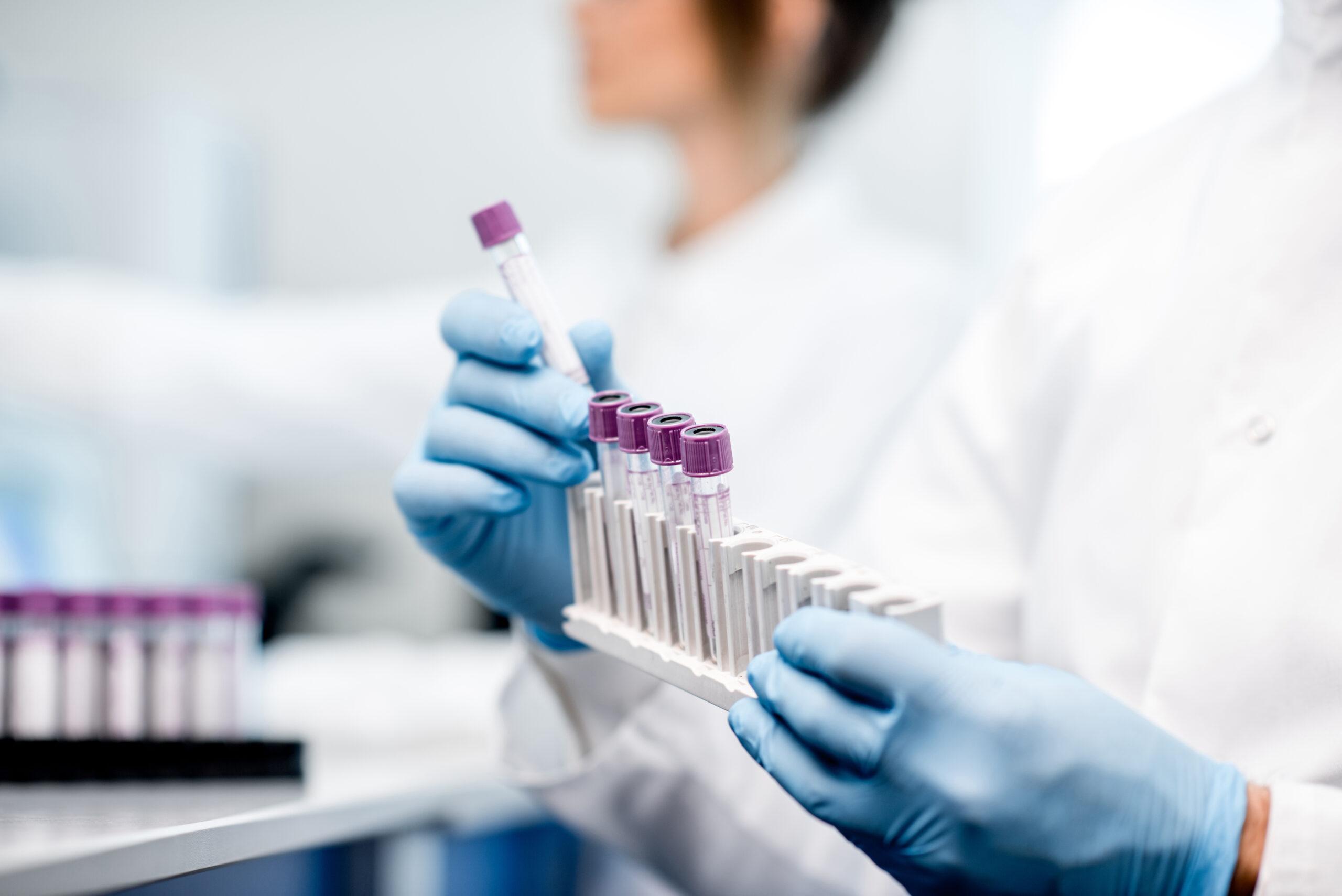 Scientist putting test tubes into a holder