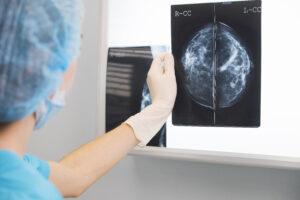 woman doctor or nurse in surgery outfit is holding a mammogram in front of x-ray illuminator