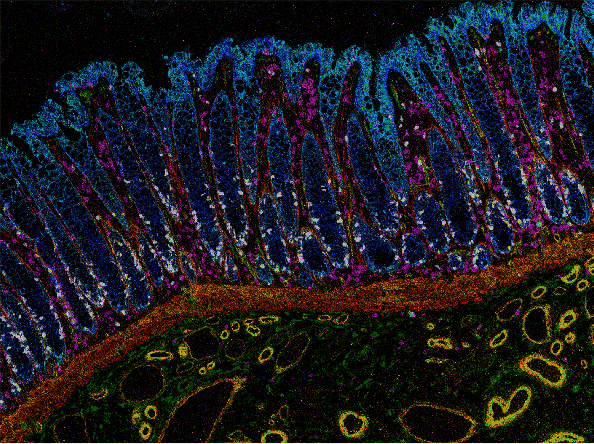 Human colonic mucosa imaged by researchers in Francesca Ciccarelli lab