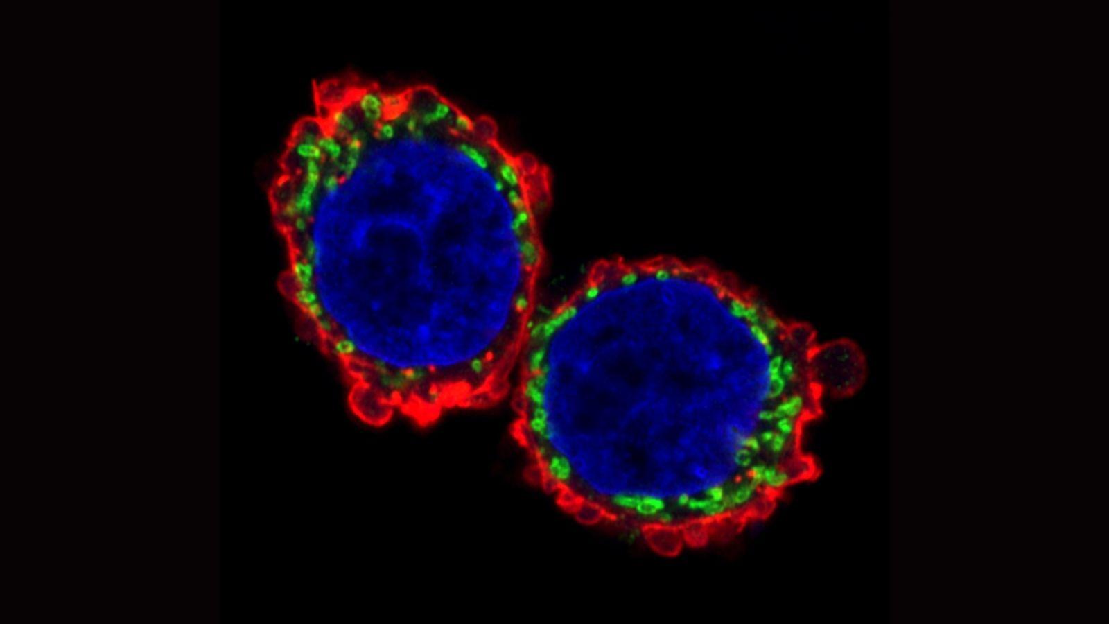 Representative image of mitochondrial network (Tom20, green), F-actin cytoskeleton (red) and nucleus (Hoechst, blue) in A375M2 rounded-amoeboid melanoma cells.