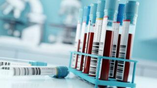 Blood samples in a laboratory