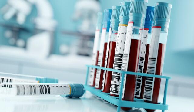 Blood samples in a laboratory