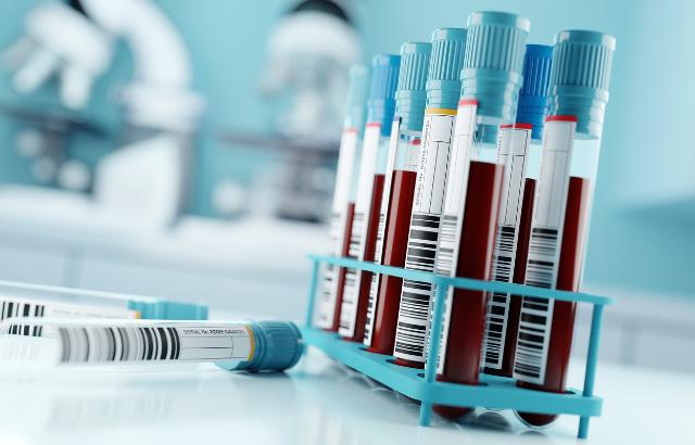 Blood samples in a laboratory