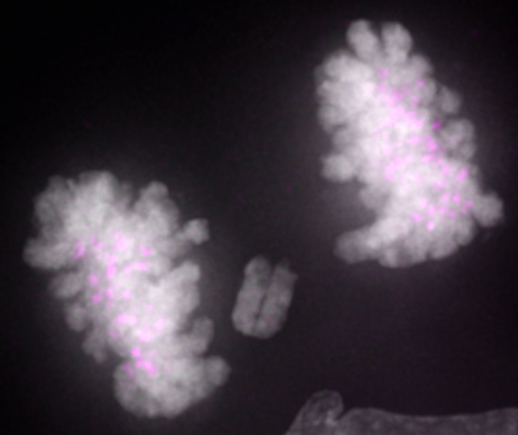 Dividing cancer cells, imaged by the McClelland lab. DNA is shown in white and centrosomes in purple. One chromosome lags behind the others, risking being segregated into the wrong cell. Errors such as these happen 30-50% of the time in dividing cancer cells, contributing to their chaotic genomes.