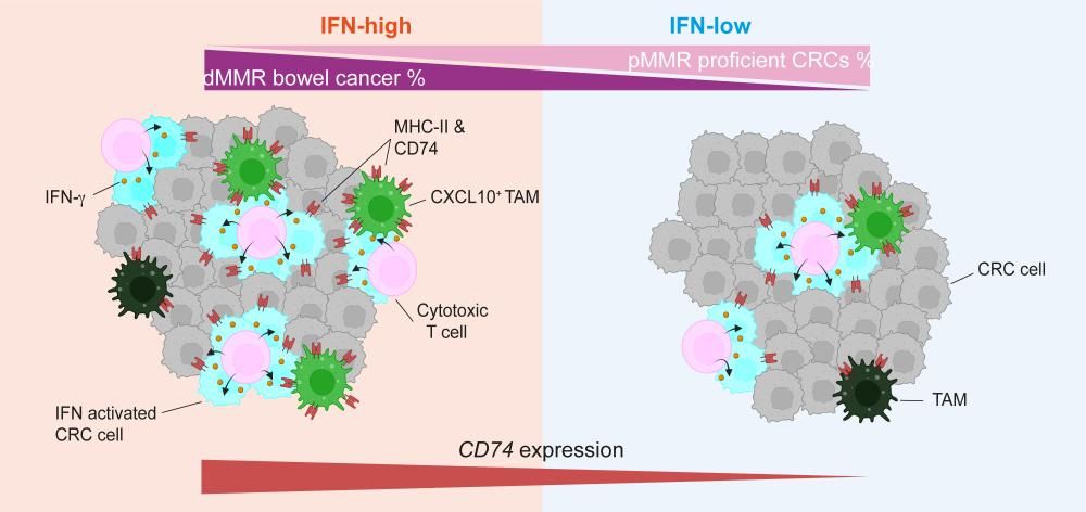 The deficient subtype (left) and proficient subtype (right) with different populations of immune cells. CD74 expression is highest in tumours with a particular type of immune environment, which is more likely to be in the deficient subtype. Acha-Sagredo, A. Andrei, P. and Clayton, K. et al. (2025). Cancer Cell.